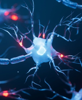 Alzheimer