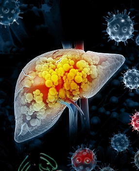 Oncology